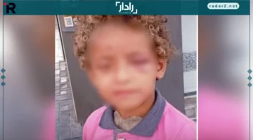 تكليف صادم.. أب يحول ابنته إلى تسول ويعتدي عليها بالعنف الشديد